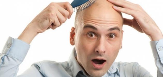 جراح تركي مختص في زراعة الشعر يحذر الرجال من مشروبات قد تسبب الصلع