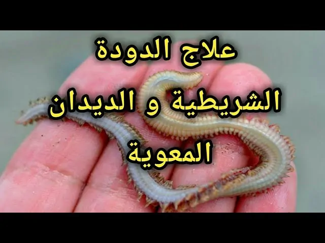 مرض خطير الدودة الشريطية