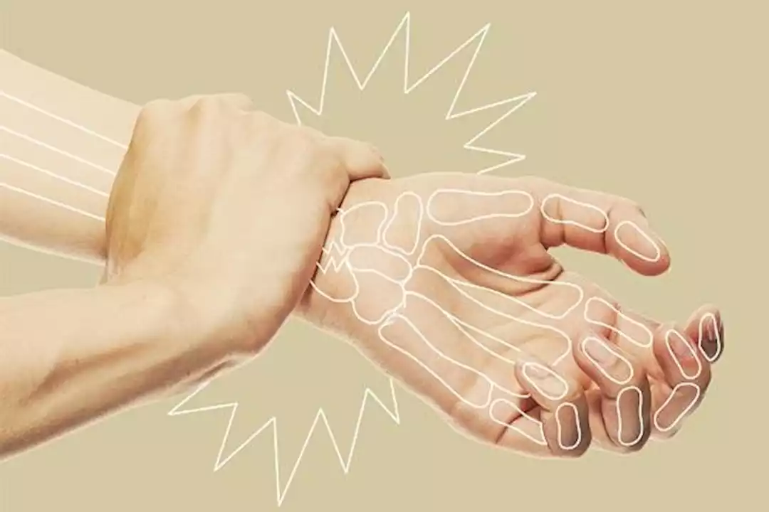 7 نصائح للوقاية من هشاشة العظام.. اتبعها