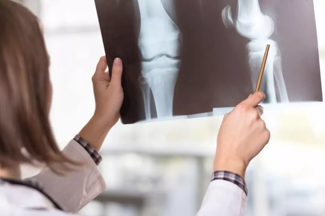 أطعمة ضرورية بعد سن الثلاثين لتعزيز صحة العظام