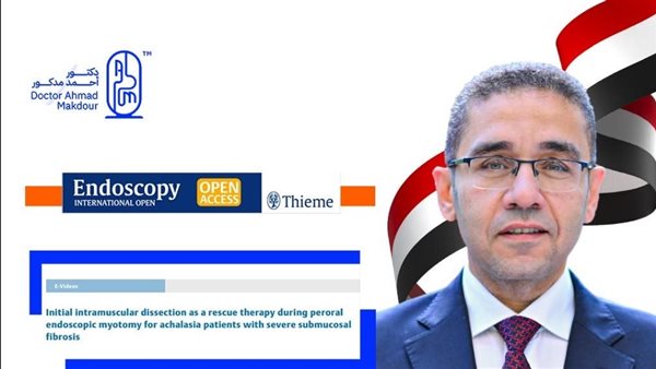 جامعة حلوان تهنئ الدكتور أحمد مدكور بعد اعتماد تقنية “مدكور” عالميًا في مجال مناظير الجهاز الهضمي