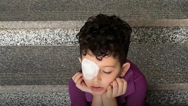 معلمة تصيب طالب بجرح في القرنية بالقليوبية.. وإجراء حاسم من التعليم
