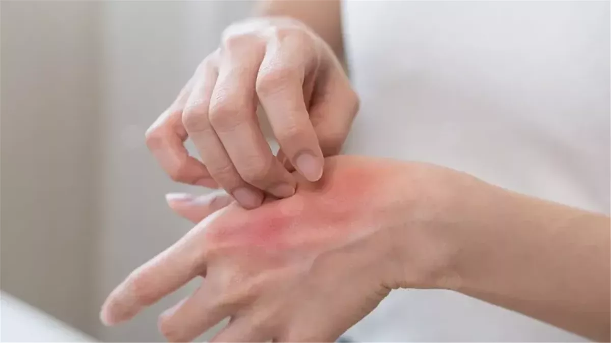 استشاري مناعة يوضح أسباب ضعف المناعة وزيادة الحساسية