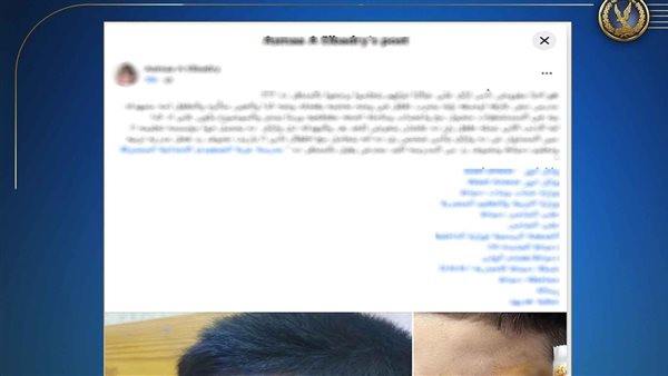 بدون قصد.. ضبط مدرس تعدى على طالب بعصا خشبية في دمياط