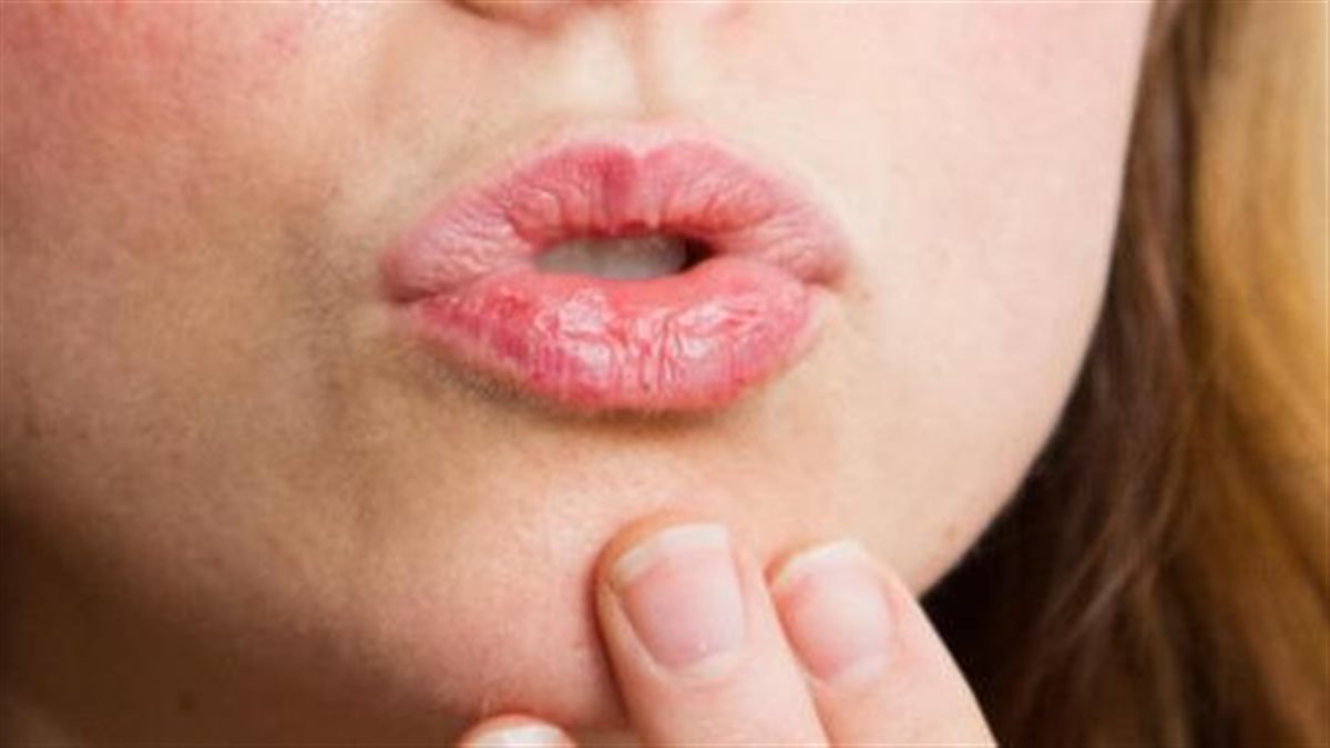 مع بداية الشتاء.. 8 طرق فعالة لعلاج تشقق الشفاة من منزلك