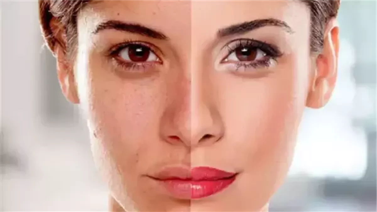 مع بداية فصل الشتاء.. روتين يومي للعناية بالبشرة الجافة