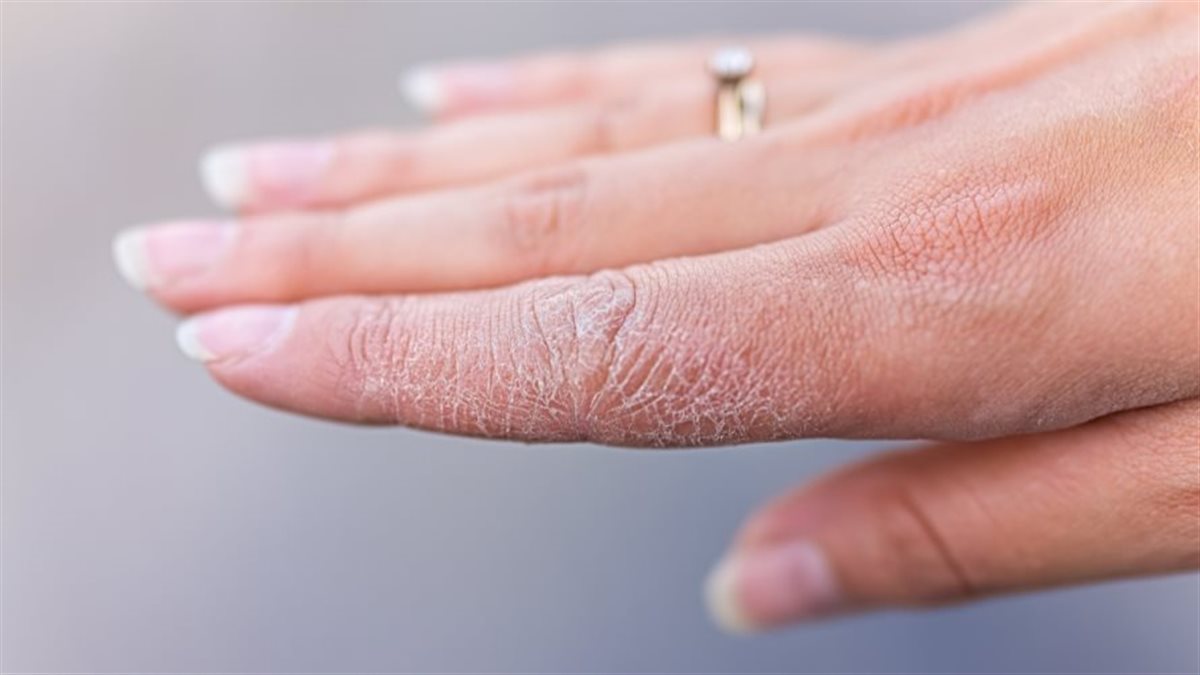 مع برودة الشتاء.. طرق طبيعية تحافظ على نعومة اليدين وتحميهما من الجفاف