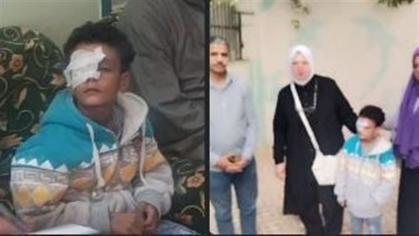 بعد أن فقد عينه.. قرار جديد بشأن طالب قنا