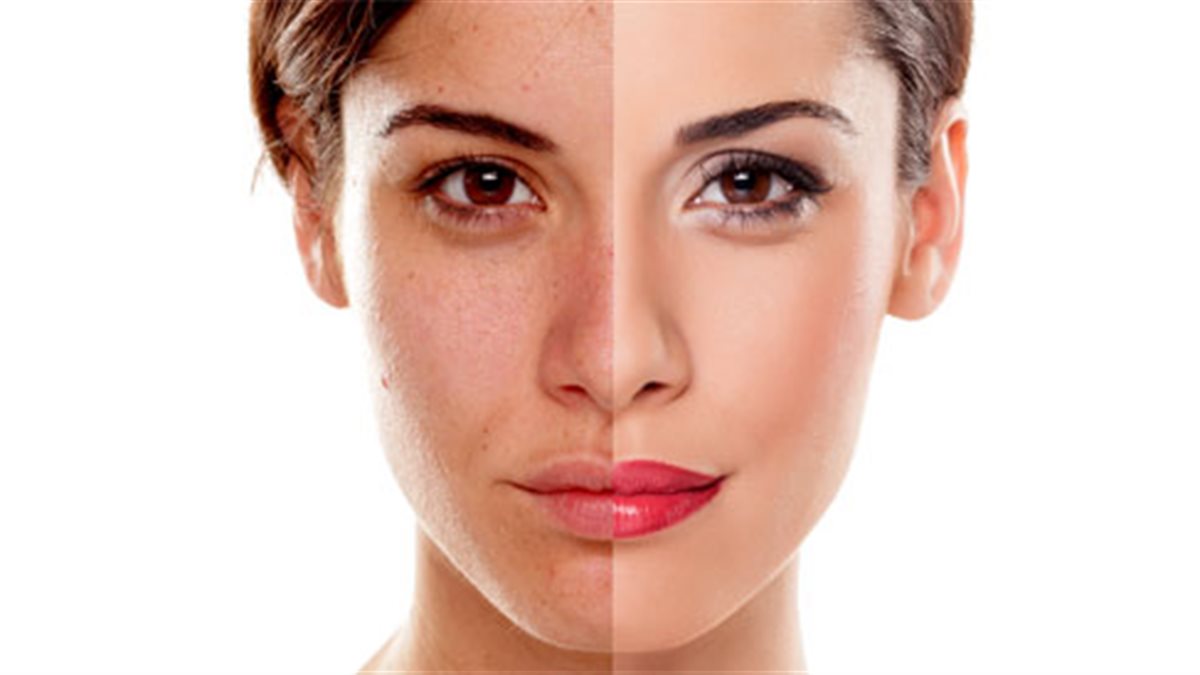 عادات يومية تُضعف حاجز البشرة.. وخطوات بسيطة لاستعادة نضارتها من جديد