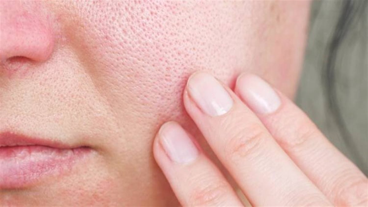 بمكونات بسيطة.. وصفات فعّالة لتضييق المسام وتحسين نضارة البشرة