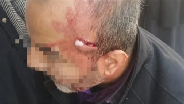 وكيل تعليم الإسماعيلية يزور المعلم المعتدى عليه بالمقص.. ويوجّه بمتابعة حالتها