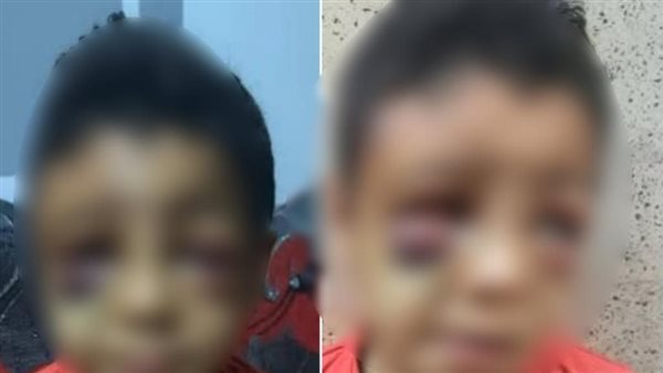 عاجل| منشور مضلل.. حقيقة إصابة طفل داخل مدرسة بقنا