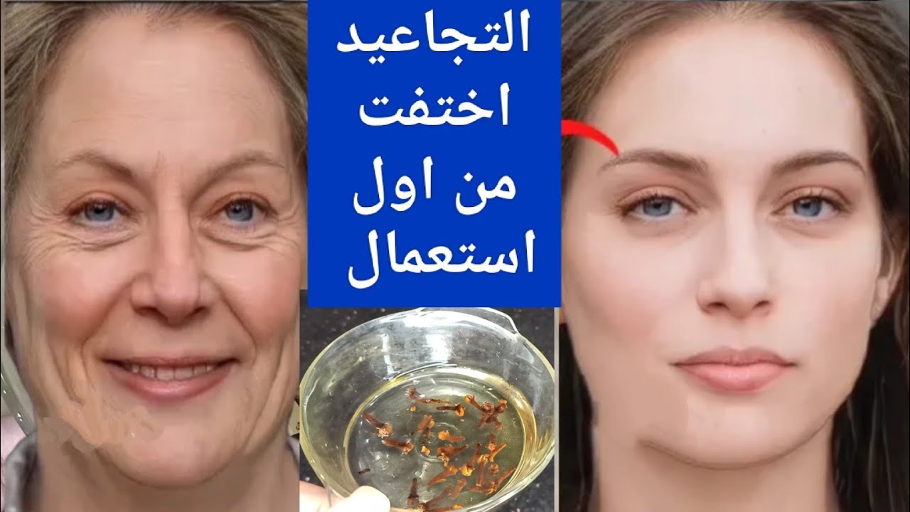أفضل زيت للوجه يزيل التجاعيد والترهلات ويشد البشرة من أول استعمال.. هيخليكي قمر 14