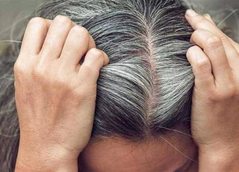 وداعاً للصبغات.. اكتشاف طريقة بسيطة للتخلص من الشعر الأبيض