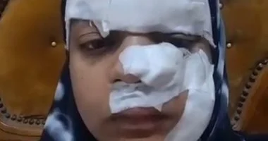 زوج يمزق وجه ويد زوجته بسبب دعوى خلع بالغربية